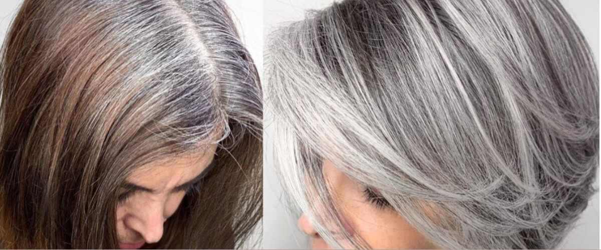 Hair graying